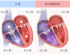 先心患者花甲之年重获“心”生 (3).png